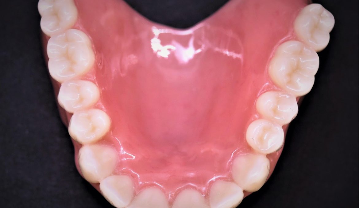 acrylic dentures 2